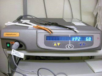 電気的なシールシステム（Gyrus plasmaKinetic Surgical Generator）